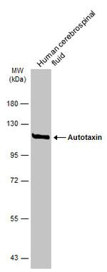 ENPP2 Antibody in Western Blot (WB)