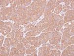 VCPIP1 Antibody in Immunohistochemistry (Paraffin) (IHC (P))