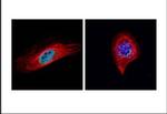 Bub1 Antibody in Immunocytochemistry (ICC/IF)