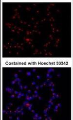 GOLPH2 Antibody in Immunocytochemistry (ICC/IF)