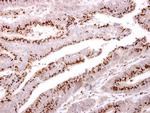 GOLPH2 Antibody in Immunohistochemistry (Paraffin) (IHC (P))