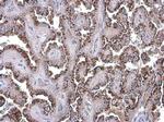 GOLPH2 Antibody in Immunohistochemistry (Paraffin) (IHC (P))