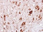 GRK2 Antibody in Immunohistochemistry (Paraffin) (IHC (P))