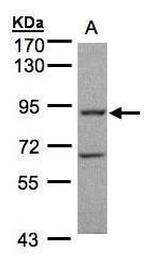 GRK2 Antibody in Western Blot (WB)