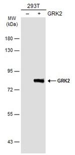 GRK2 Antibody in Western Blot (WB)