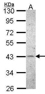 CK2 alpha-1 Antibody in Western Blot (WB)