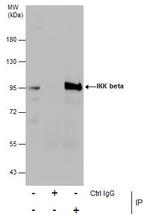 IKK beta Antibody in Immunoprecipitation (IP)