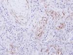 OPRM1 Antibody in Immunohistochemistry (Paraffin) (IHC (P))