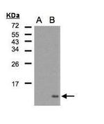 CCL5 (RANTES) Antibody in Western Blot (WB)