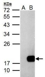 DCTD Antibody in Western Blot (WB)