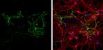 GFAP Antibody in Immunocytochemistry (ICC/IF)