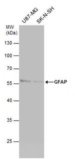 GFAP Antibody in Western Blot (WB)