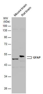 GFAP Antibody in Western Blot (WB)