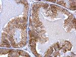 ACVR1 Antibody in Immunohistochemistry (Paraffin) (IHC (P))