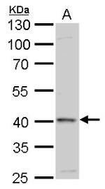 GALK1 Antibody in Western Blot (WB)