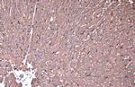 beta Actin Antibody in Immunohistochemistry (Paraffin) (IHC (P))