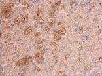 beta Actin Antibody in Immunohistochemistry (Paraffin) (IHC (P))