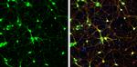 PGP9.5 Antibody in Immunocytochemistry (ICC/IF)