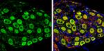 PGP9.5 Antibody in Immunohistochemistry (Paraffin) (IHC (P))