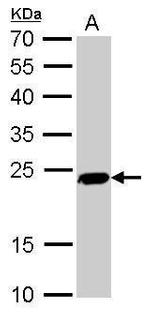 PGP9.5 Antibody in Western Blot (WB)