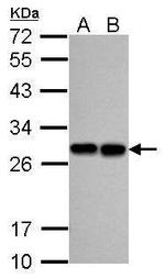 PGP9.5 Antibody in Western Blot (WB)