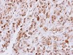 CDT1 Antibody in Immunohistochemistry (Paraffin) (IHC (P))