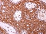 Bax Antibody in Immunohistochemistry (Paraffin) (IHC (P))