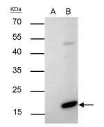 Bax Antibody in Immunoprecipitation (IP)