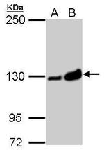 Vinculin Antibody in Western Blot (WB)