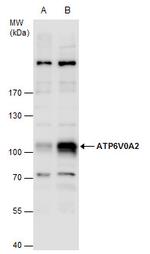 ATP6V0A2 Antibody in Western Blot (WB)