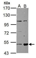 ALDH3A2 Antibody in Western Blot (WB)