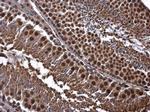 CDK8 Antibody in Immunohistochemistry (Paraffin) (IHC (P))