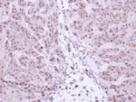 NFkB p105 Antibody in Immunohistochemistry (Paraffin) (IHC (P))