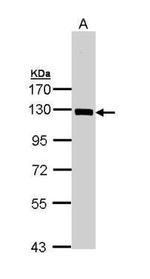 NFkB p105 Antibody in Western Blot (WB)