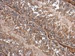 SMAD2 Antibody in Immunohistochemistry (Paraffin) (IHC (P))