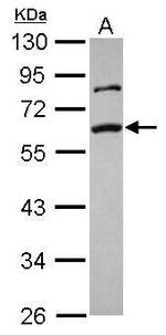 SMAD2 Antibody in Western Blot (WB)