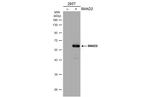 SMAD2 Antibody in Western Blot (WB)