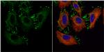 Catenin alpha-1 Antibody in Immunocytochemistry (ICC/IF)