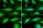 Catenin alpha-1 Antibody in Immunocytochemistry (ICC/IF)