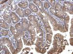 Catenin alpha-1 Antibody in Immunohistochemistry (Paraffin) (IHC (P))