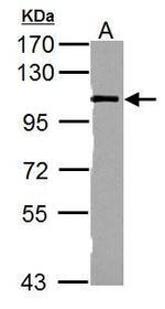 Catenin alpha-1 Antibody in Western Blot (WB)