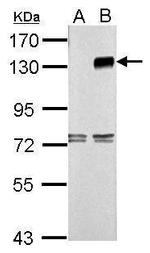 TLR9 Antibody in Western Blot (WB)