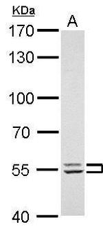 Lyn Antibody in Western Blot (WB)