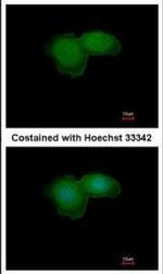 BTK Antibody in Immunocytochemistry (ICC/IF)