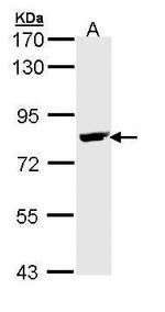 BTK Antibody in Western Blot (WB)