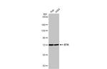 BTK Antibody in Western Blot (WB)