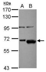 AKT2 Antibody in Western Blot (WB)