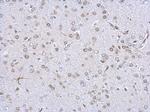 Lamin A/C Antibody in Immunohistochemistry (Paraffin) (IHC (P))