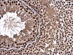 CA150 Antibody in Immunohistochemistry (Paraffin) (IHC (P))