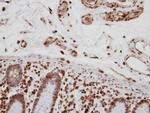 CA150 Antibody in Immunohistochemistry (Paraffin) (IHC (P))